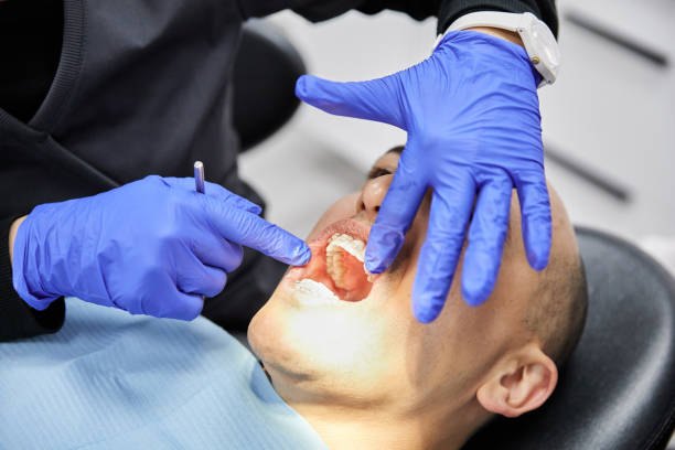 Best Emergency Gum Treatment in Harrison, OH