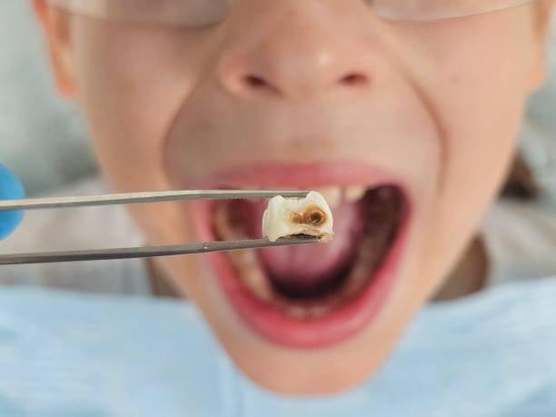 Best Cosmetic Emergency Dentistry in Harrison, OH